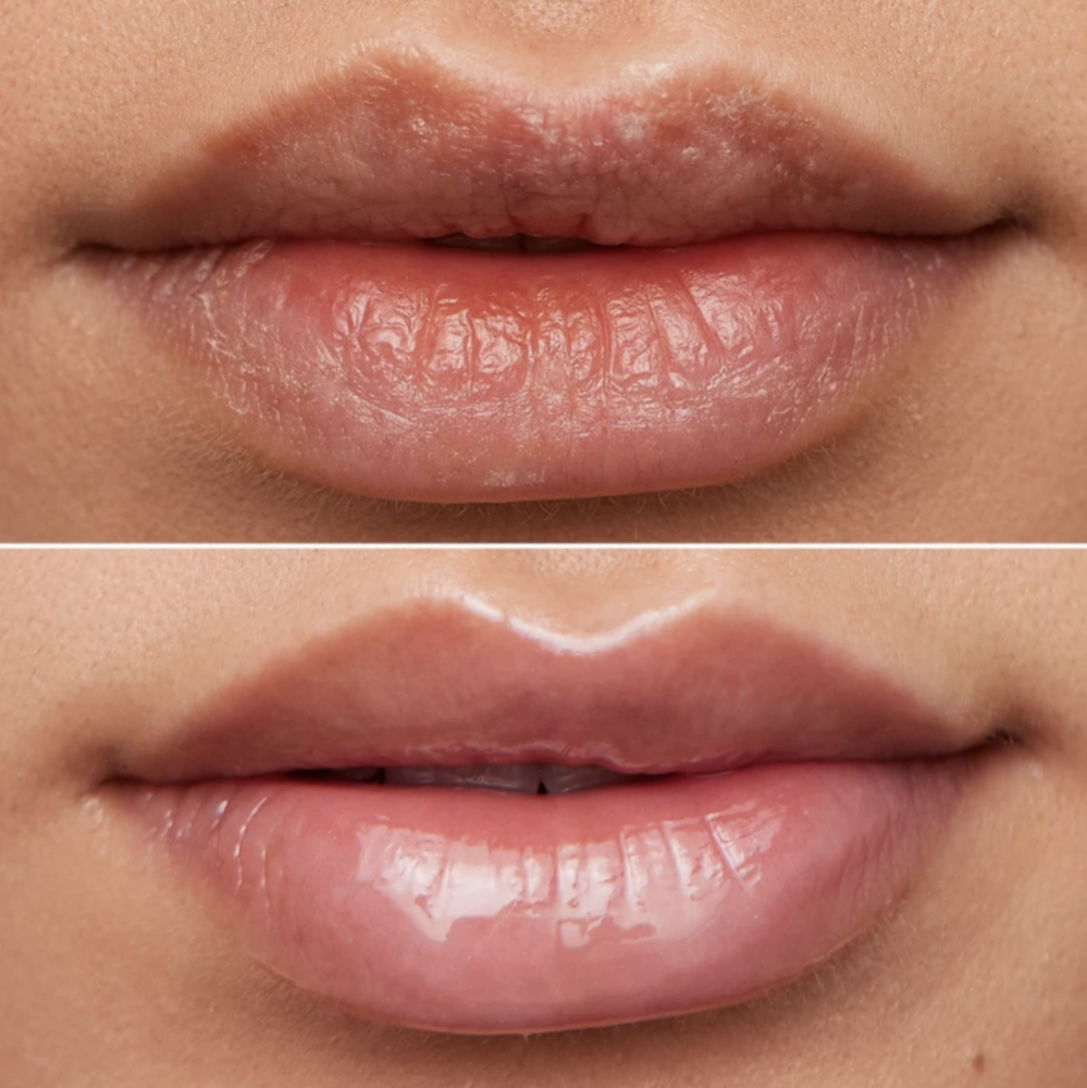 Wonderskin Lip Rehab Serum Oil - Clear