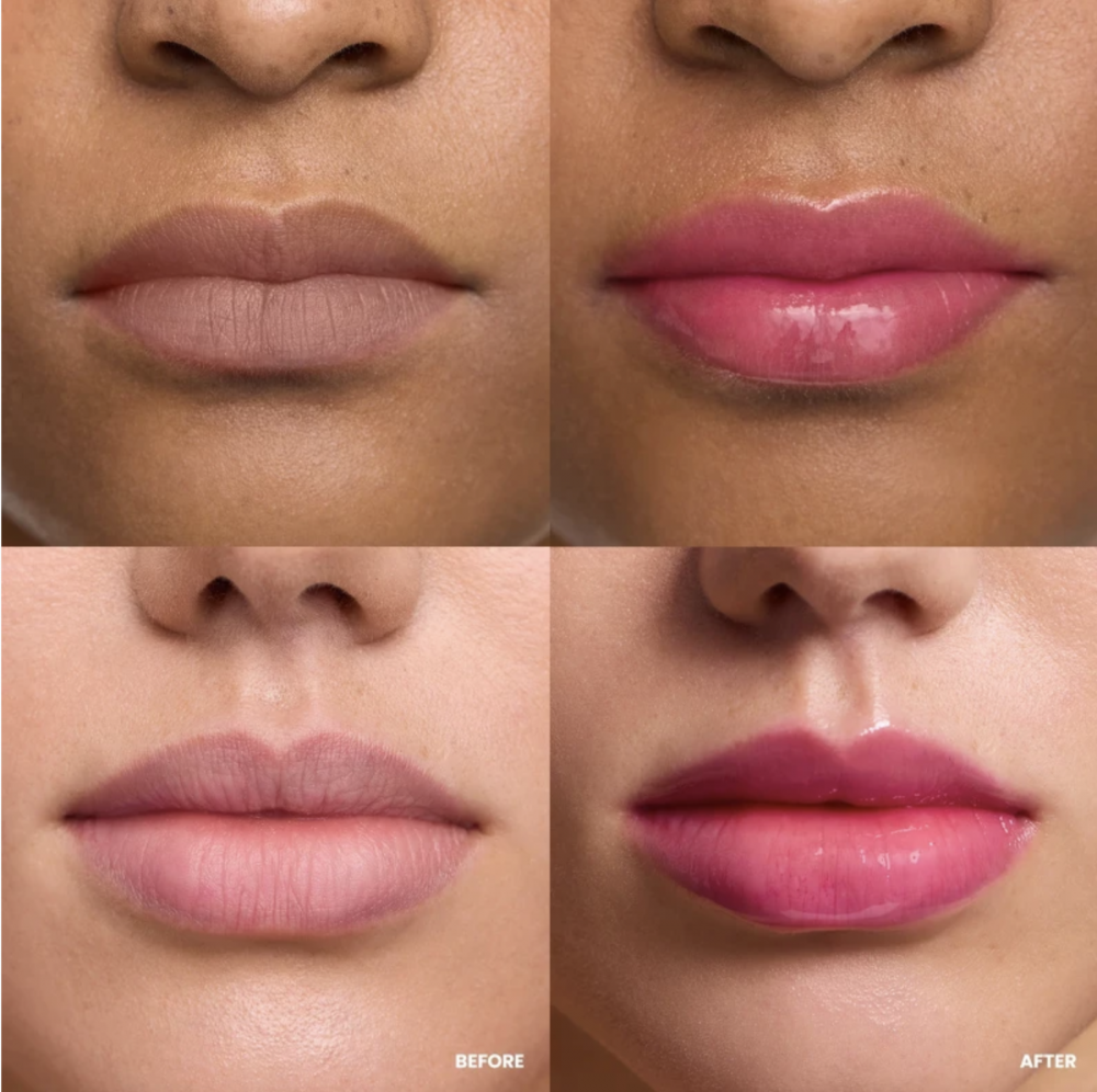 Wonderskin Lip Rehab Serum Oil - Kissed