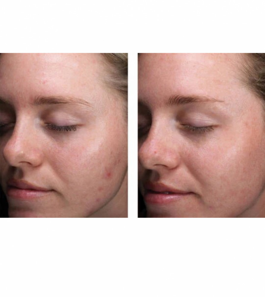 ALPHARET CLEARING SERUM - på lager skal bestilles på mail