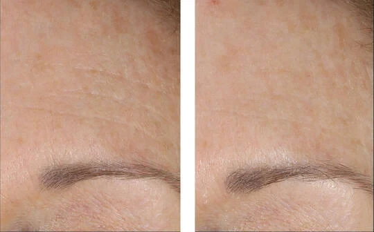 ALPHARET OVERNIGHT CREAM - på lager skal bestilles på mail