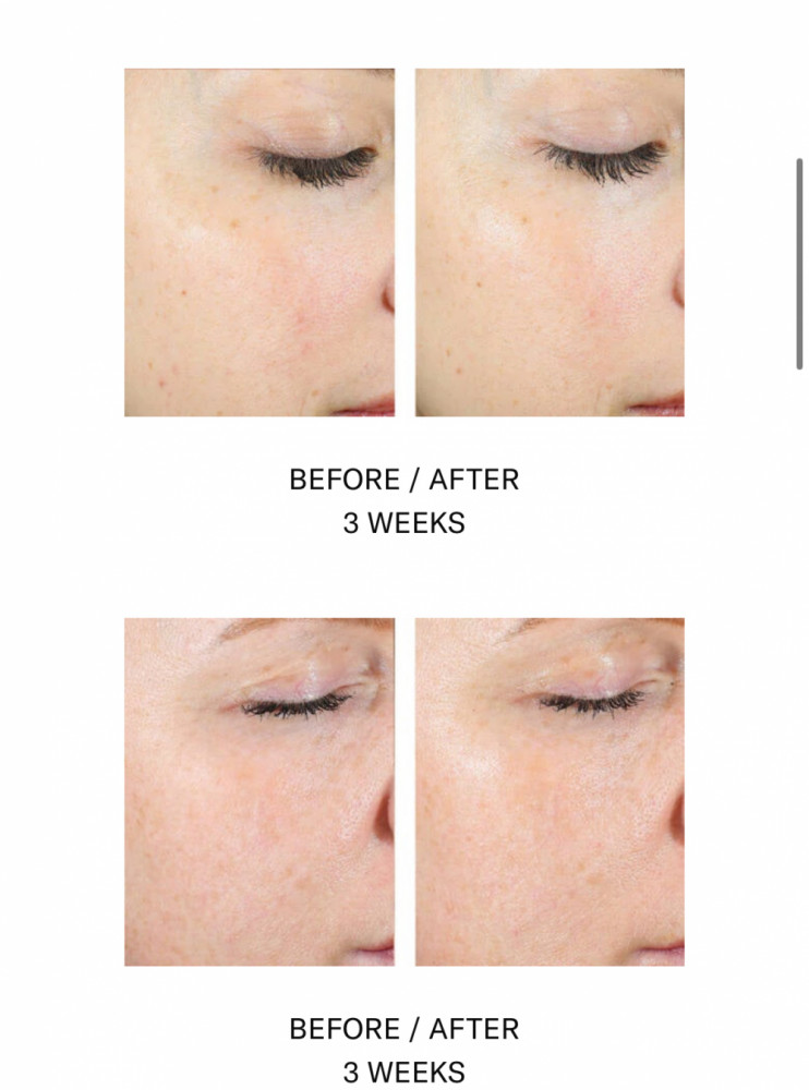 ALPHARET PEEL PADS 30 stk - på lager skal bestilles på mail