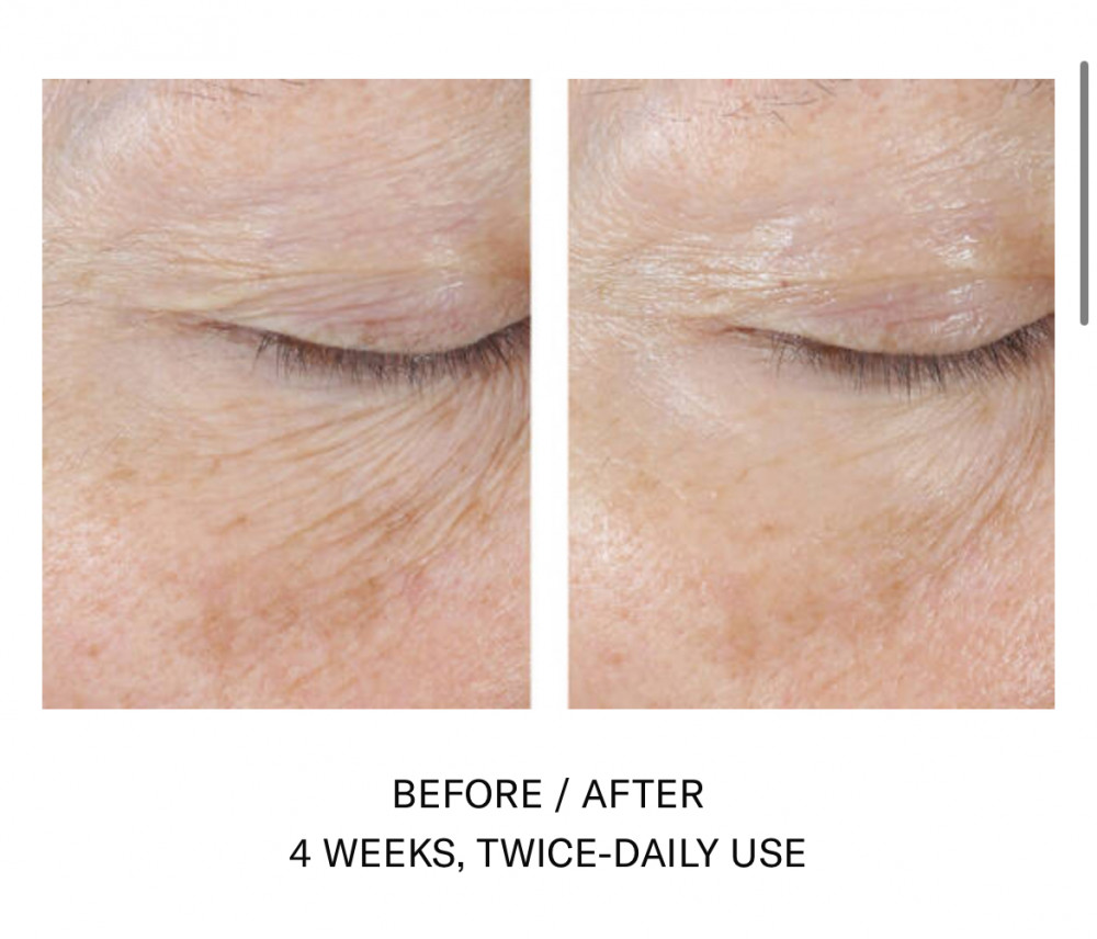 InterFuse Treatment Cream EYE - på lager skal bestilles på mail