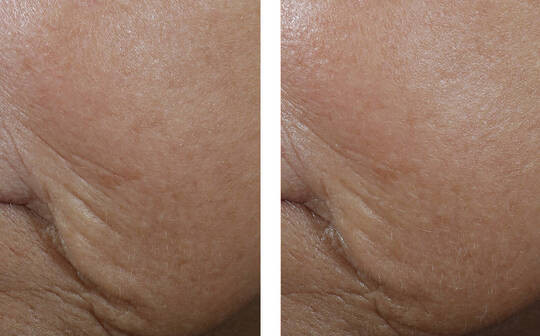 Interfuse Treatment Cream Face&Neck - på lager skal bestilles på mail